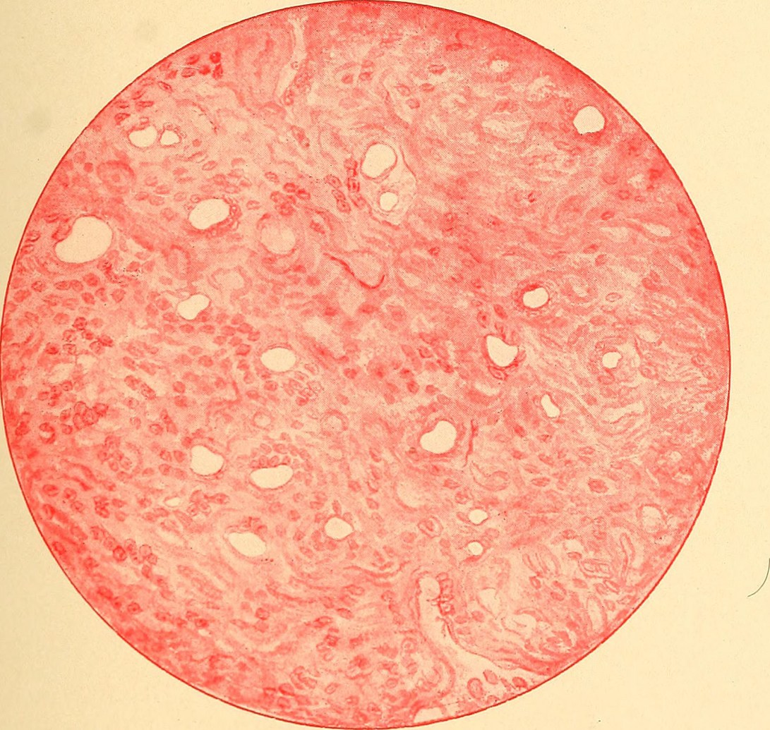 14765483382_23332b0c58_h